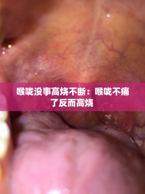 喉咙没事高烧不断：喉咙不痛了反而高烧 