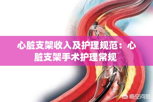 心脏支架收入及护理规范：心脏支架手术护理常规 