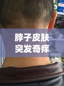 脖子皮肤突发奇痒：脖子皮肤瘙痒是什么原因引起 