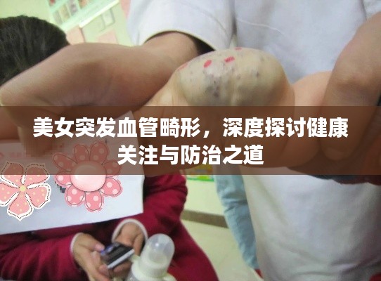 美女突发血管畸形，深度探讨健康关注与防治之道