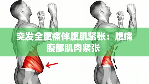 突发全腹痛伴腹肌紧张：腹痛腹部肌肉紧张 
