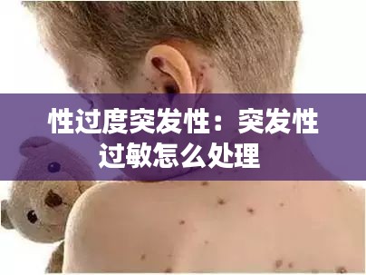 性过度突发性：突发性过敏怎么处理 