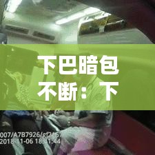 下巴暗包不断：下巴出现包块 