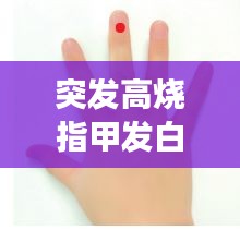突发高烧指甲发白：发烧了指甲会变紫色吗 