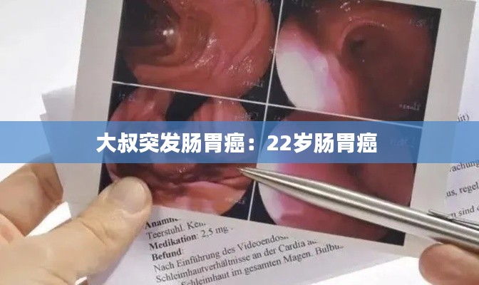 大叔突发肠胃癌：22岁肠胃癌 