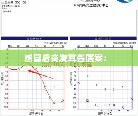 感冒后突发耳聋医案： 