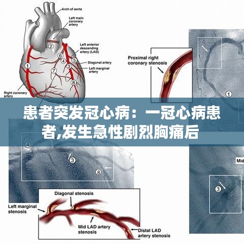 患者突发冠心病：一冠心病患者,发生急性剧烈胸痛后 