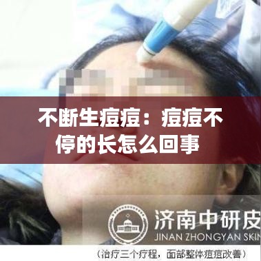 不断生痘痘：痘痘不停的长怎么回事 