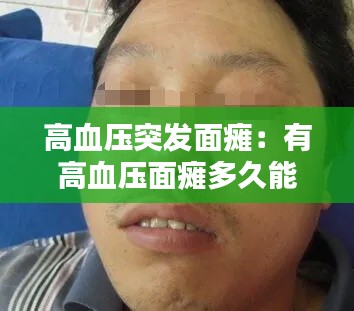 高血压突发面瘫：有高血压面瘫多久能完全恢复 