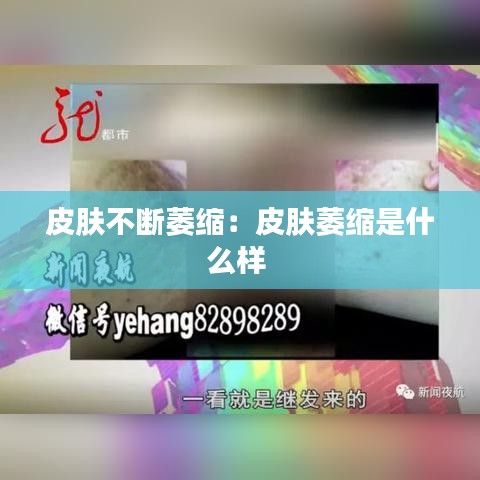 皮肤不断萎缩：皮肤萎缩是什么样 