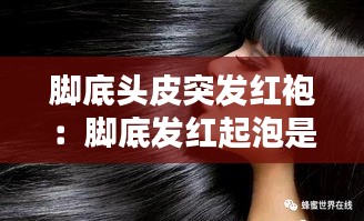 脚底头皮突发红袍：脚底发红起泡是因为什么原因 