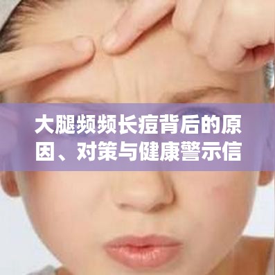 大腿频频长痘背后的原因、对策与健康警示信号