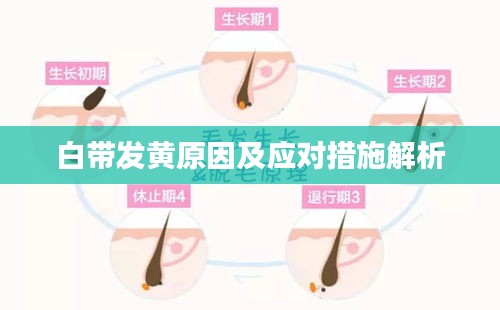 白带发黄原因及应对措施解析