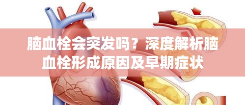脑血栓会突发吗？深度解析脑血栓形成原因及早期症状