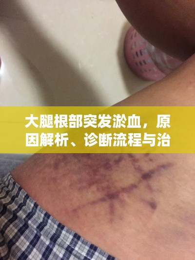 大腿根部突发淤血，原因解析、诊断流程与治疗方案