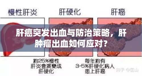 肝癌突发出血与防治策略，肝肿瘤出血如何应对？