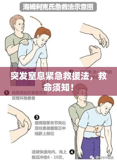 突发窒息紧急救援法，救命须知！