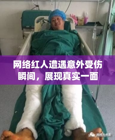 网络红人遭遇意外受伤瞬间，展现真实一面